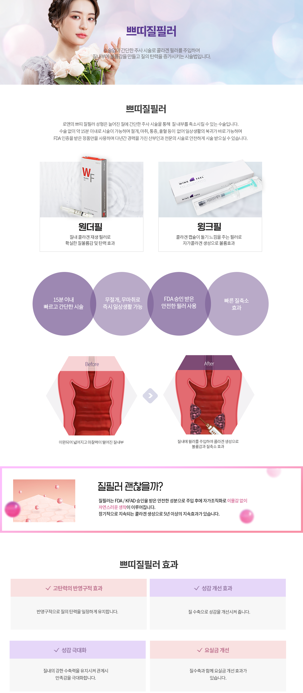 로앤의 쁘띠 질필러 성형은 늘어진 질에 간단한 주사 시술을 통해  질 내부를 축소시킬 수 있는 수술입니다.
수술 없이 약 15분 이내로 시술이 가능하며 절개, 마취, 통증, 출혈 등이  없어 일상생활의 복귀가 바로 가능하며
FDA 인증을 받은 정품만을 사용하며 다년간 경력을 가진 산부인과 전문의 시술로 안전하게 시술 받으실 수 있습니다.